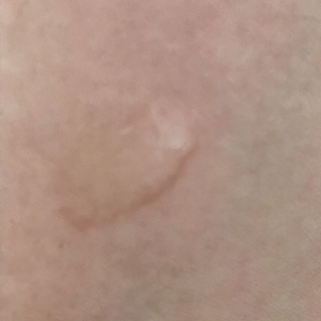 美容液化粧水/麗凍化粧品/化粧水を使ったクチコミ(2枚目)