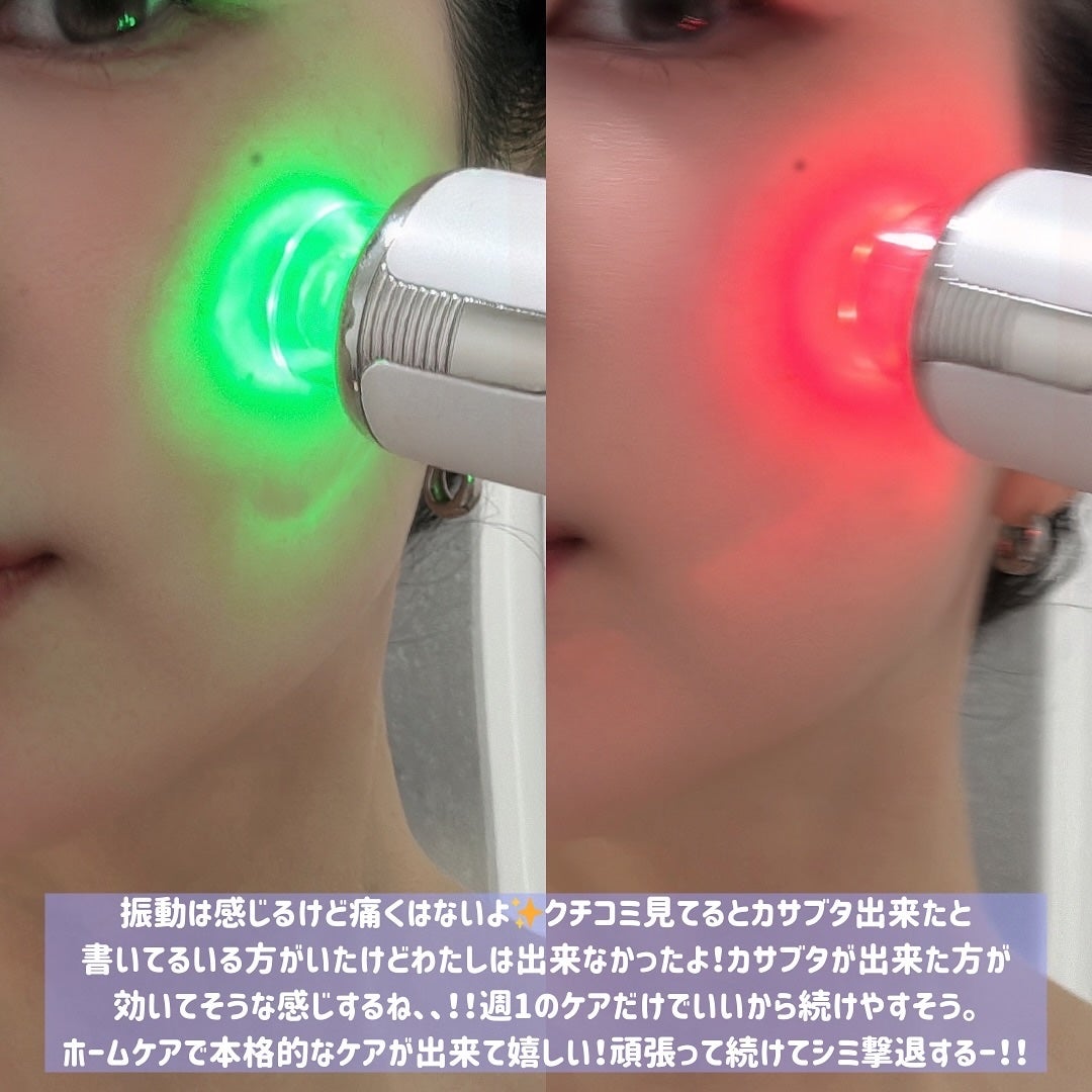 メリタンショットガン/セルオロジー/美顔器・マッサージを使ったクチコミ(7枚目)