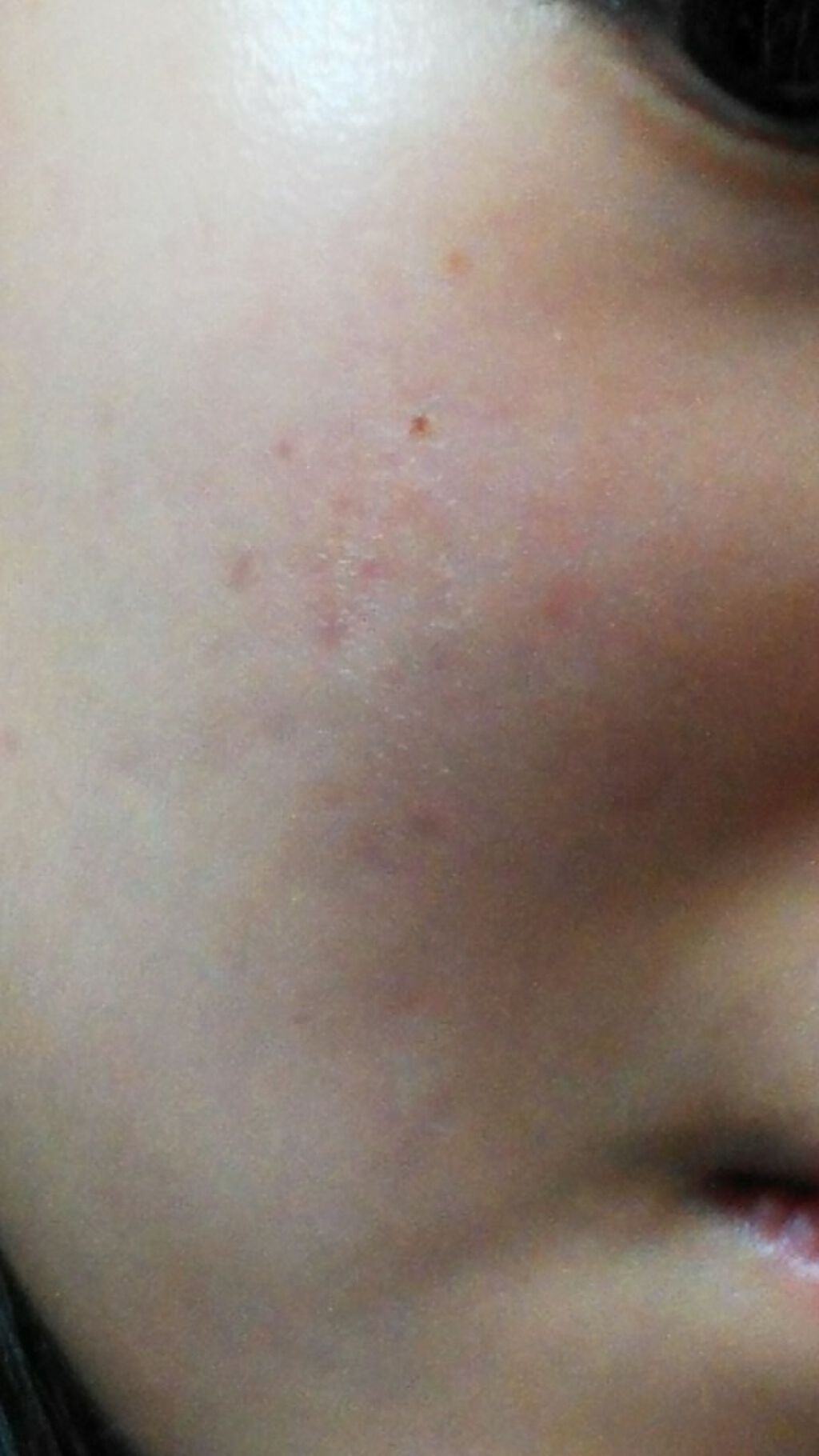 薬用 しみ 集中対策 美容液/メラノCC/美容液を使ったクチコミ(2枚目)