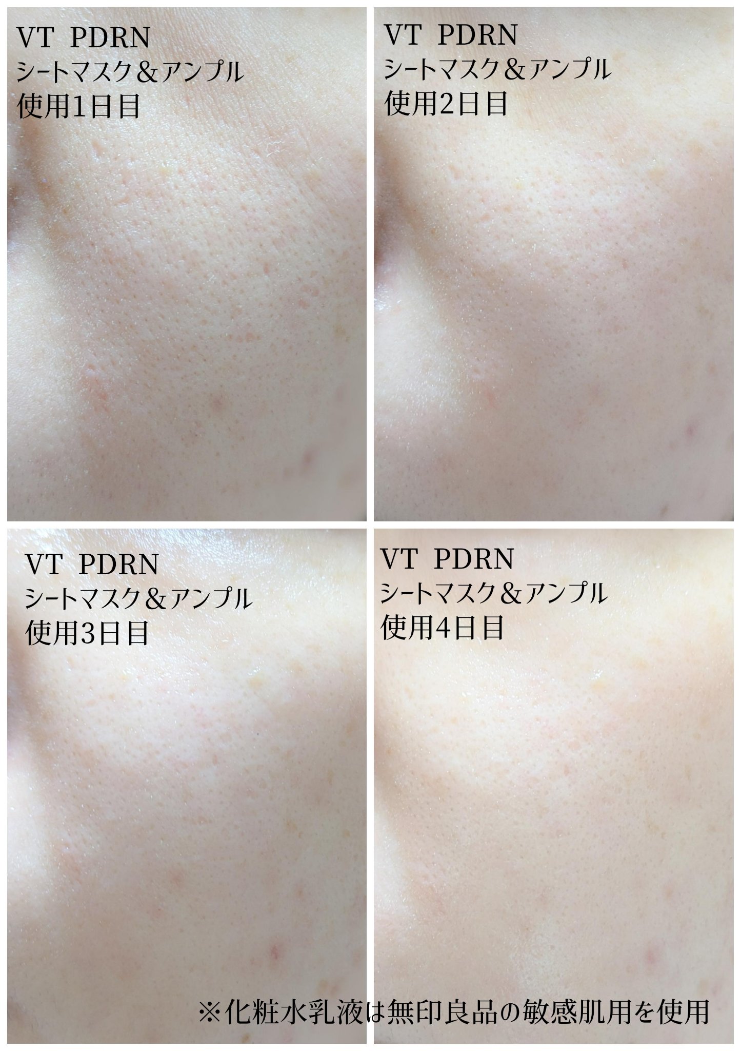 PDRN+ デイリーマスク/VT/シートマスク・パックを使ったクチコミ（3枚目）