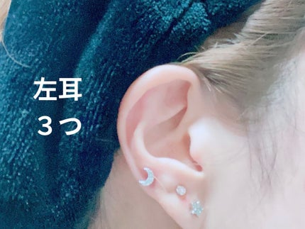 ドルマイシン軟膏(医薬品)/ゼリア新薬工業/その他を使ったクチコミ(3枚目)