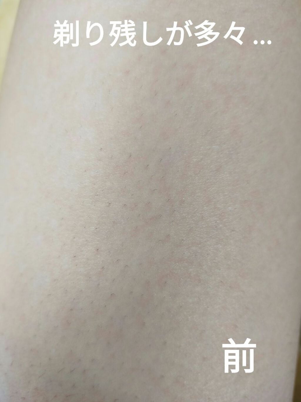 イントゥイション 敏感肌用 ホルダー (刃付き)+替刃1コ/イントゥイション/シェーバーを使ったクチコミ(2枚目)