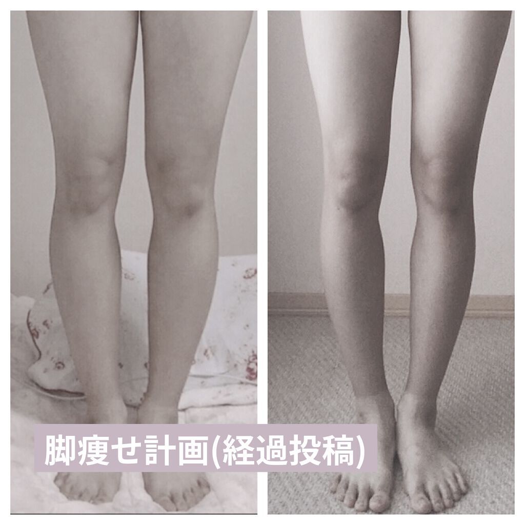 ニベアクリーム/ニベア/ボディクリームを使ったクチコミ（1枚目）