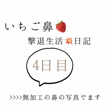 いちご鼻撃退日記4日目！

どんどん下から生えてきて気がするから、
長期戦になりそうな予感😮
継続頑張ります💪🏼

なんか毛穴が赤いポツポツになってる〜

唇にも同時にやると、めっちゃ良い！


#いち