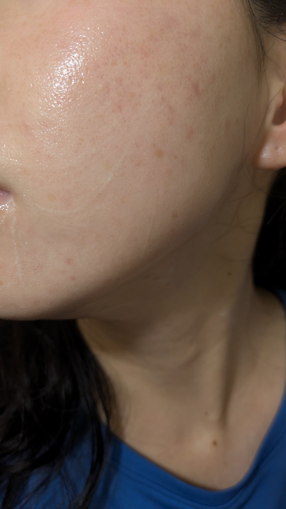 A2+NAG2ソリューション/The Ordinary/美容液を使ったクチコミ（2枚目）