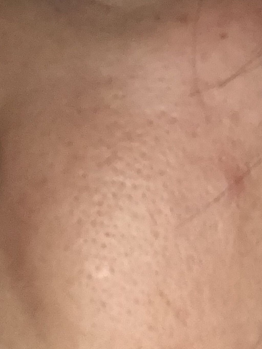 CICA マイルドトナーパッド/VT/トナーパッドを使ったクチコミ（3枚目）