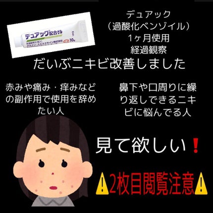 オードムーゲ 薬用ローション(ふきとり化粧水)/オードムーゲ/拭き取り化粧水を使ったクチコミ(1枚目)