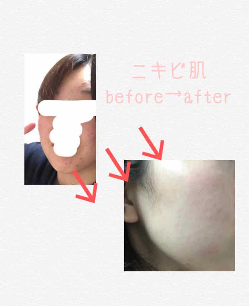 菊正宗 日本酒の化粧水 高保湿/菊正宗/化粧水を使ったクチコミ（1枚目）