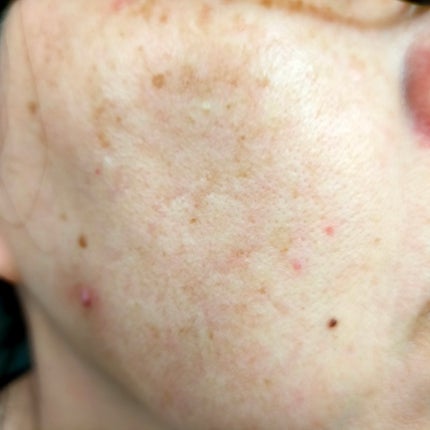 ピンクアロエメレンゲクレンザー/APRILSKIN/その他洗顔料を使ったクチコミ(5枚目)