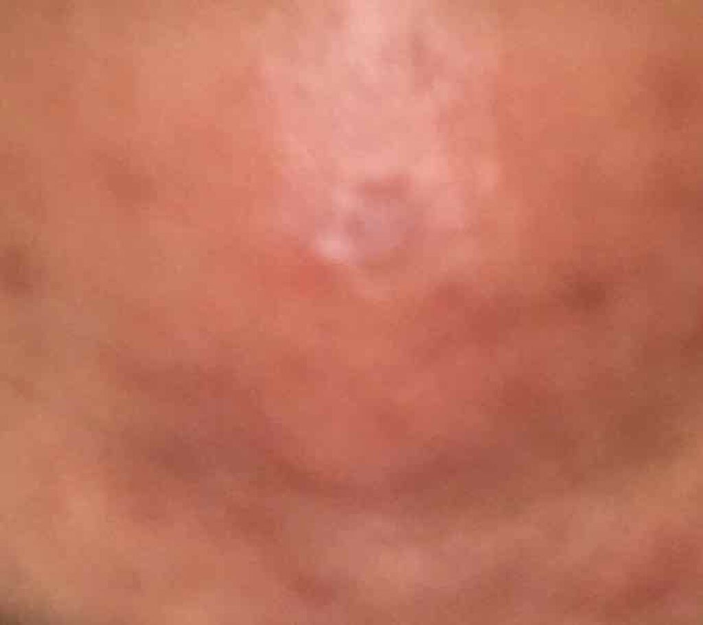 twinkle_lips_c6o on LIPS 「2月4日触ってざらつきが少しなくなったような、肌が白くなったよ..」(3枚目)