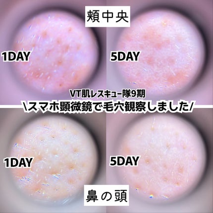 シカレチA エッセンス0.1/VT/美容液を使ったクチコミ(5枚目)