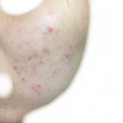 化粧水・敏感肌用・高保湿タイプ/無印良品/化粧水を使ったクチコミ(2枚目)