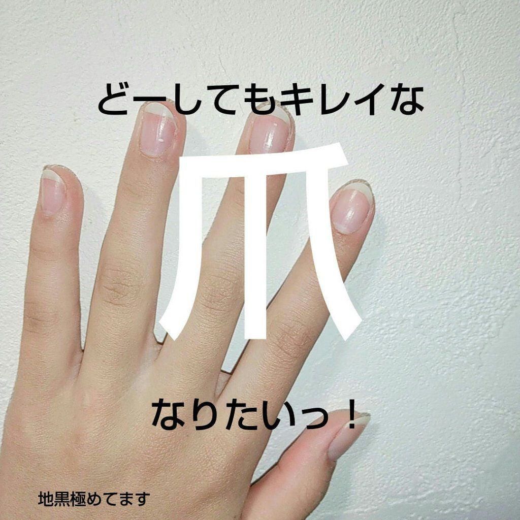 キューティクルオイル/ネイルホリック/ネイルオイル・トリートメントを使ったクチコミ(1枚目)