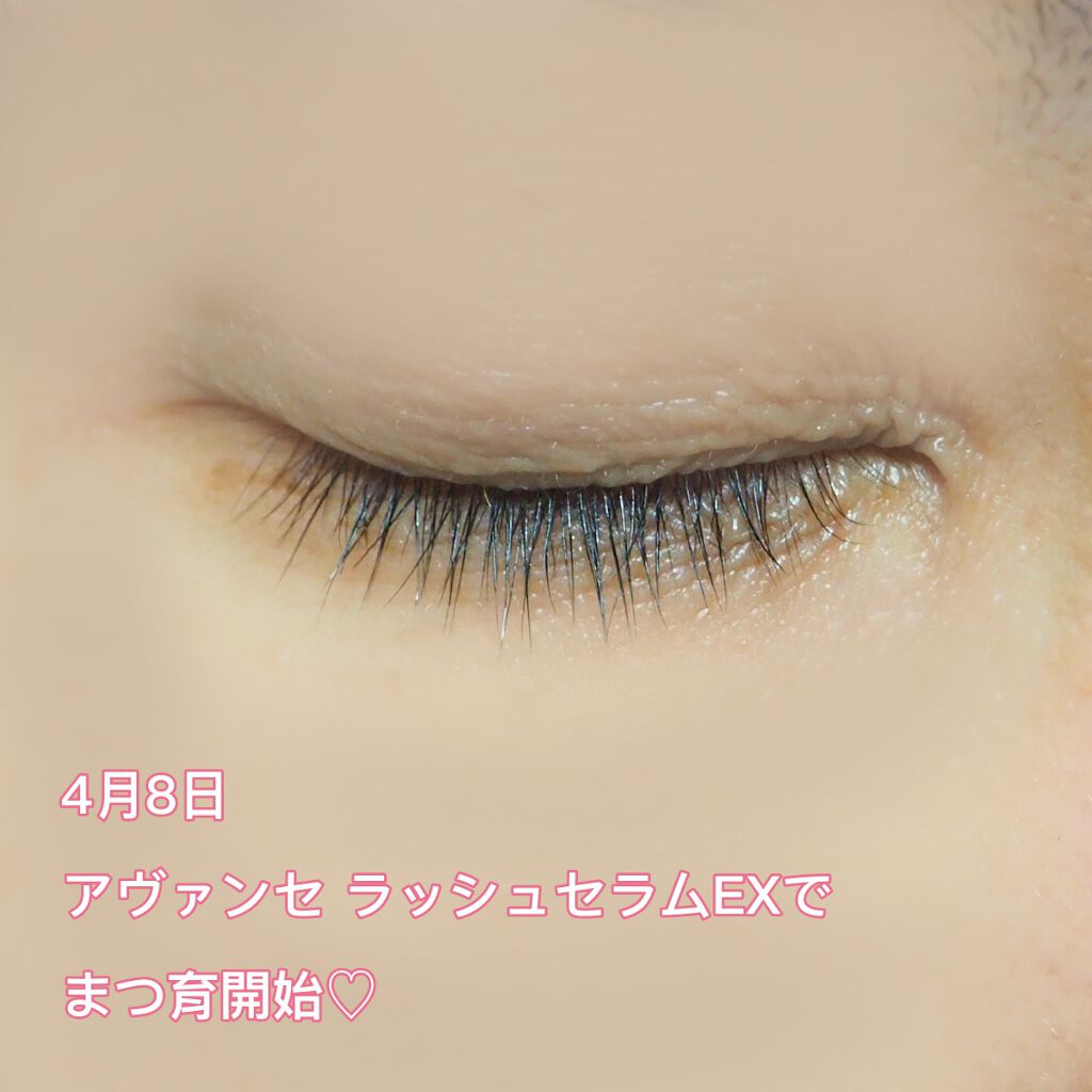 ひなた on LIPS 「❣⃛2枚目に目のアップ写真ありますのでご注意❣⃛おはようござい..」(2枚目)