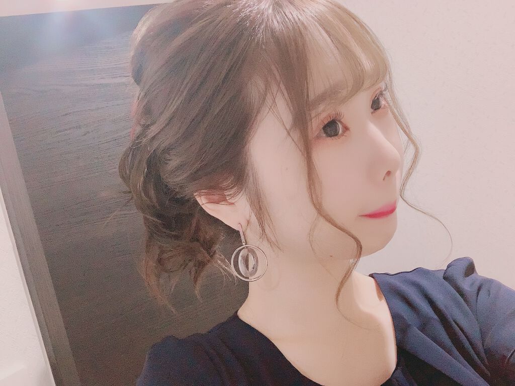 二重整形/その他を使ったクチコミ（2枚目）