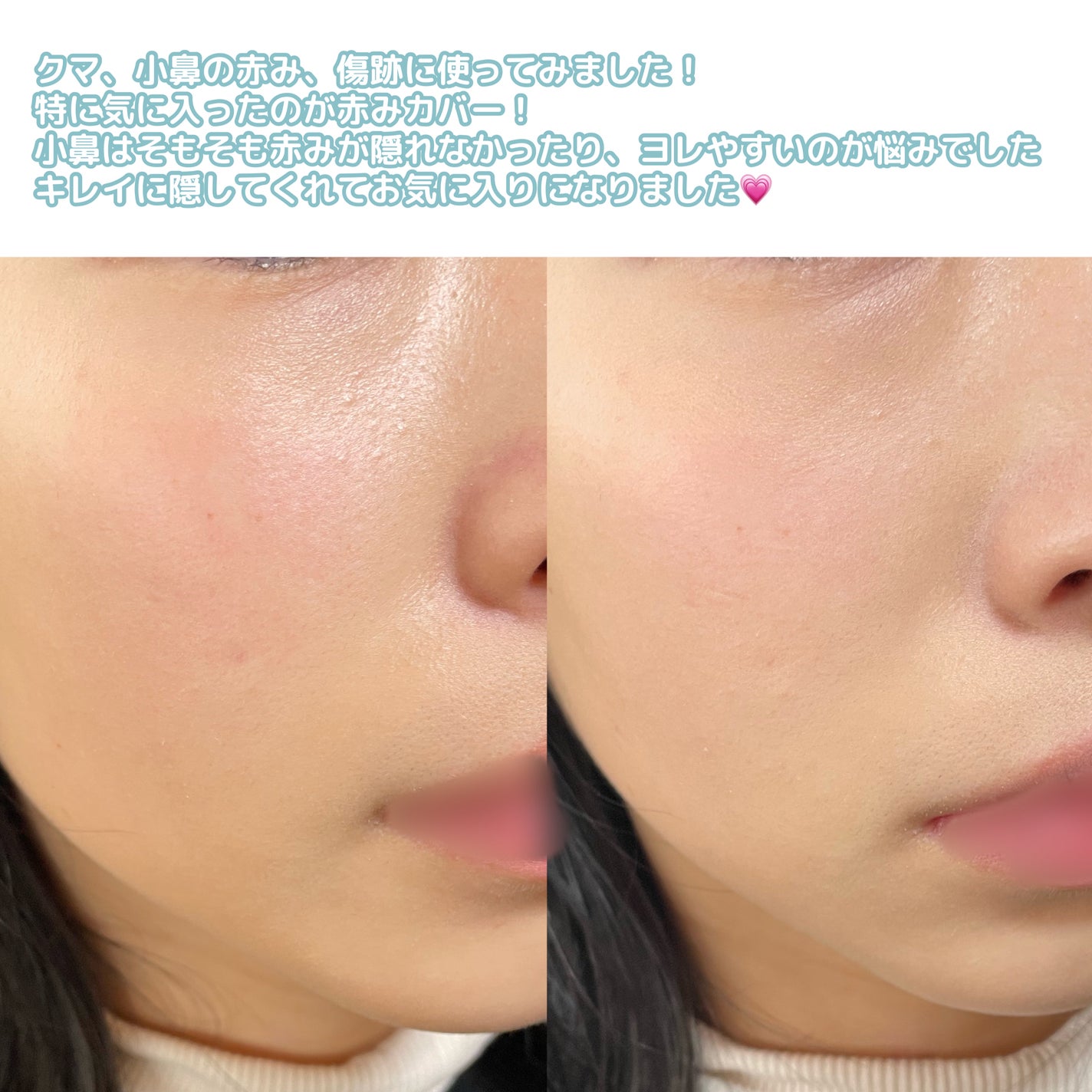 TIMAGE クリーミーコンシーラーパレット/TIMAGE/パレットコンシーラーを使ったクチコミ(6枚目)