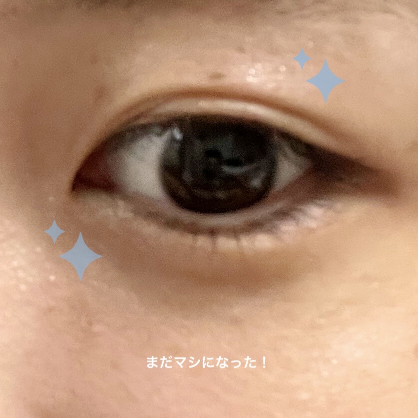 アイトーク 通常版/アイトーク/二重まぶた用アイテムを使ったクチコミ（3枚目）