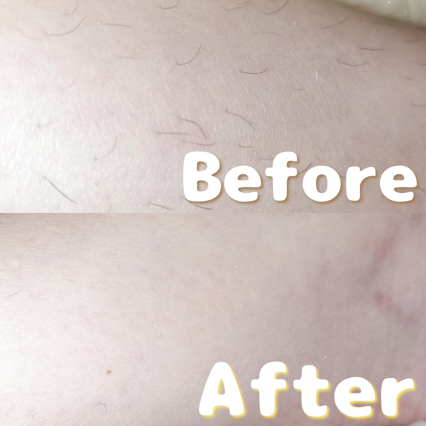 3 in 1脱毛器 (ボディ用脱毛器)/PURPLE GORILLA/家庭用脱毛器を使ったクチコミ(7枚目)