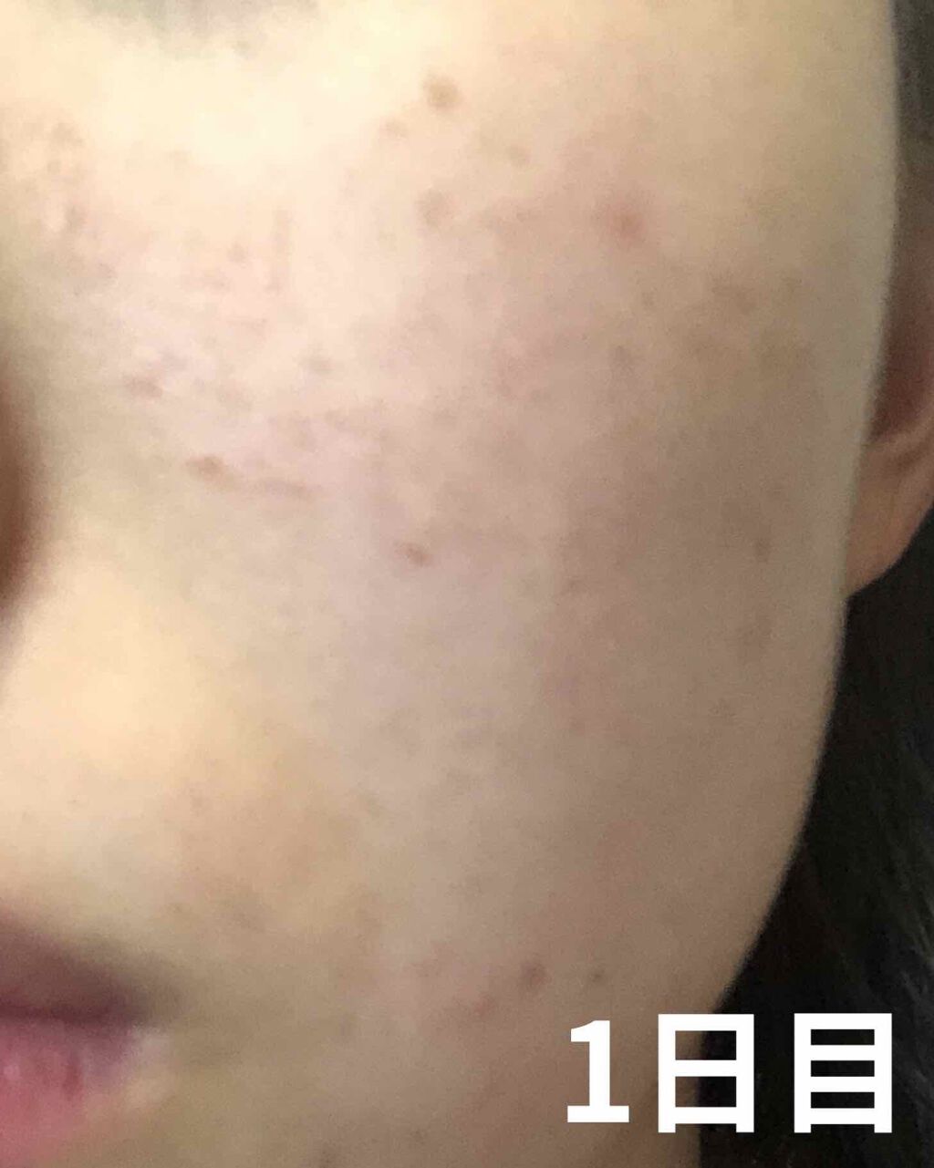 EclatCharme(エクラシャルム)/FABIUS/オールインワン化粧品を使ったクチコミ（2枚目）