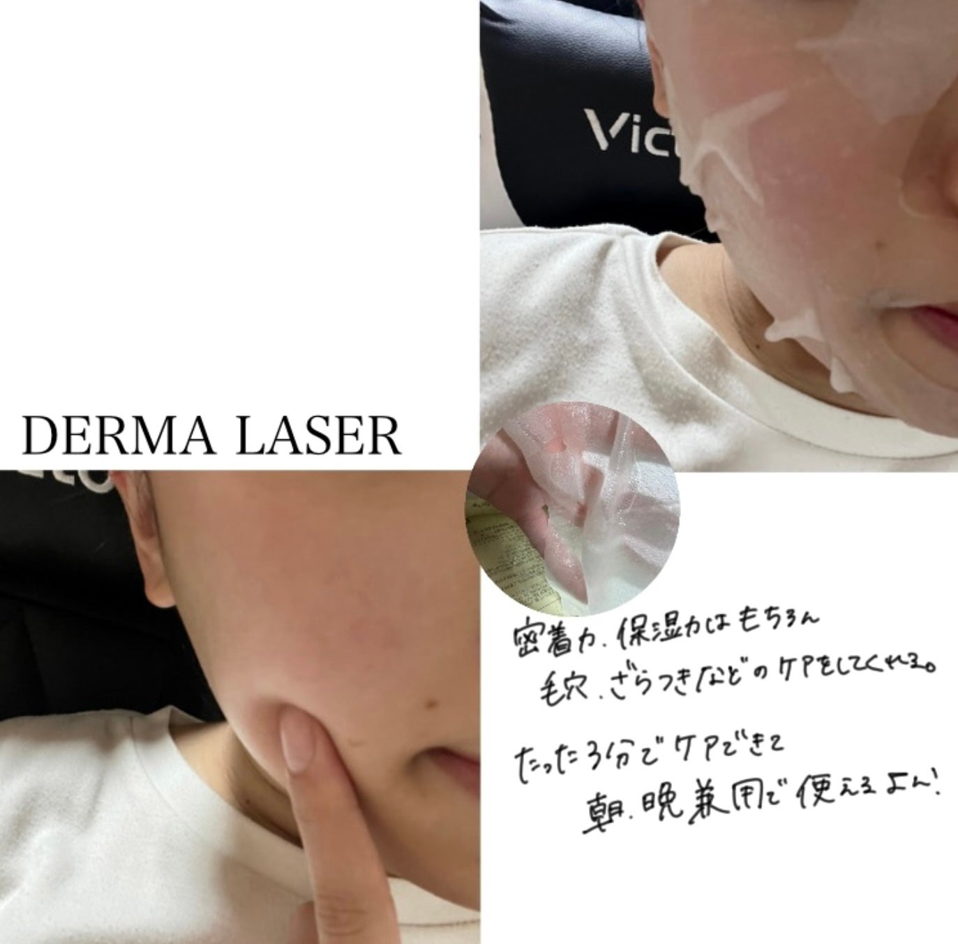 ダーマレーザースーパーVC100マスク/クオリティファースト/シートマスク・パックを使ったクチコミ(7枚目)