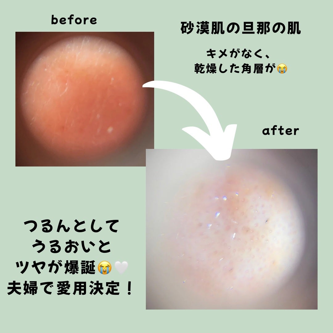 kazumið¿ïžð on LIPS ãæ¯æ¥äœ¿ãã·ãŒããã¹ã¯ãšããã°VTïŒïŒïŒããããçš®é¡ããããã©ç ..ãïŒ4æç®ïŒ