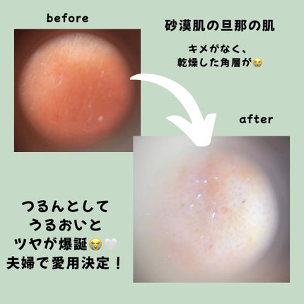 kazumið¿ïžð on LIPS ãæ¯æ¥äœ¿ãã·ãŒããã¹ã¯ãšããã°VTïŒïŒïŒããããçš®é¡ããããã©ç ..ãïŒ4æç®ïŒ