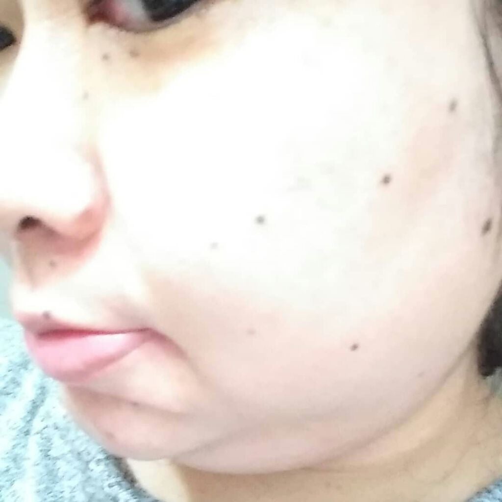 みなたん on LIPS 「こんにちは🍀この度、MEGURIEファーストミルクエッセンスを..」(4枚目)