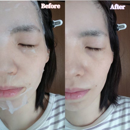 夏雪草バランシングマスク/我的美麗日記/シートマスク・パックを使ったクチコミ(7枚目)