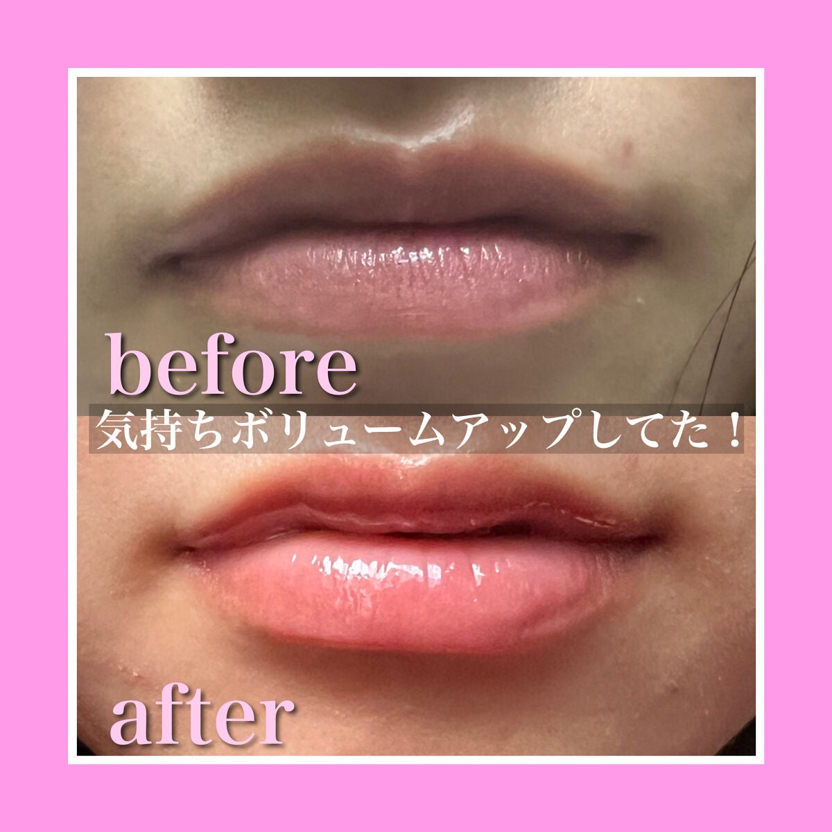 エッセンス リッププランパー/Visée/リッププランパーを使ったクチコミ(3枚目)