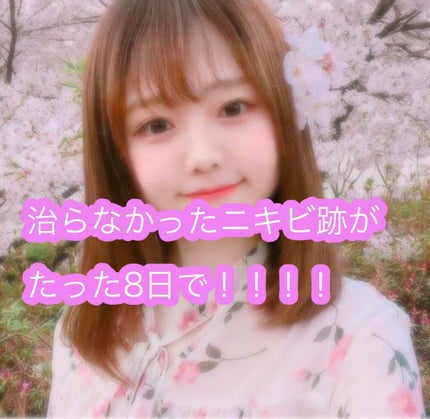 봉봉이॰˳ཻ̊♡ on LIPS 「肌荒れがたった8日で変わった!!!!!!!!最強のアイテムを紹..」(1枚目)