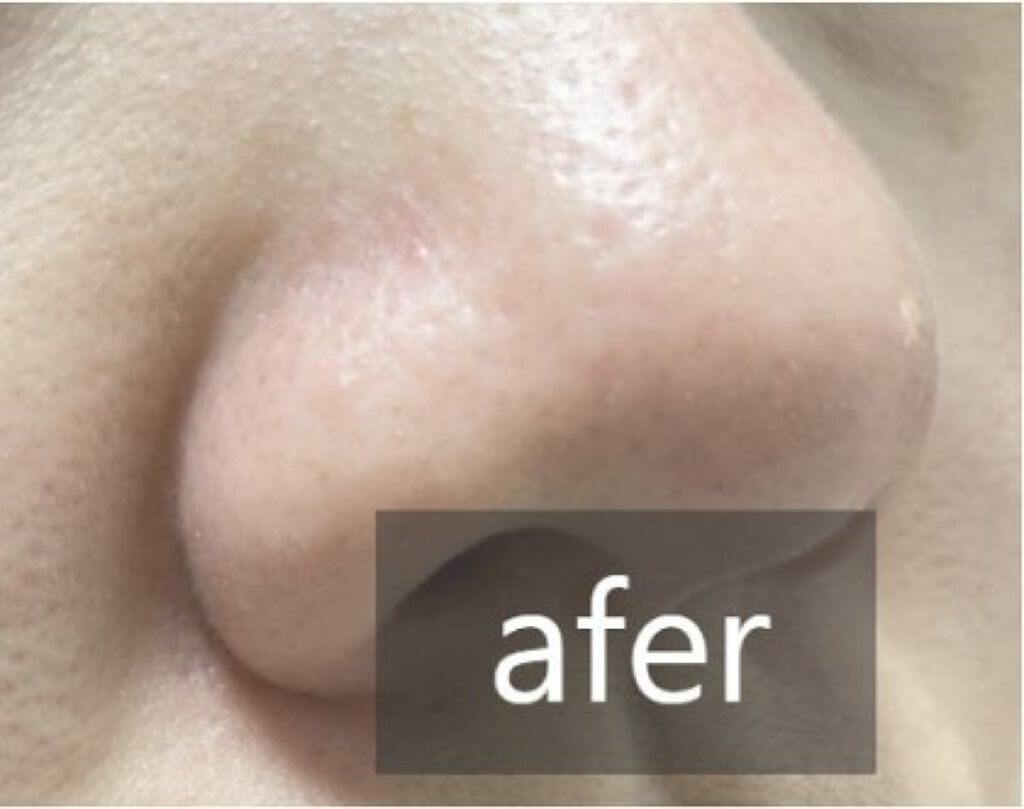 Cell Energy Liquid Face Cleanser/MORIQUENDI/クレンジングジェルを使ったクチコミ（2枚目）