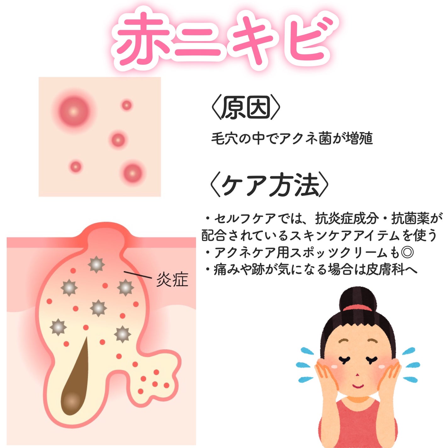 潤浸保湿 フェイスクリーム/キュレル/フェイスクリームを使ったクチコミ(4枚目)