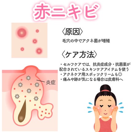 潤浸保湿 フェイスクリーム/キュレル/フェイスクリームを使ったクチコミ(4枚目)