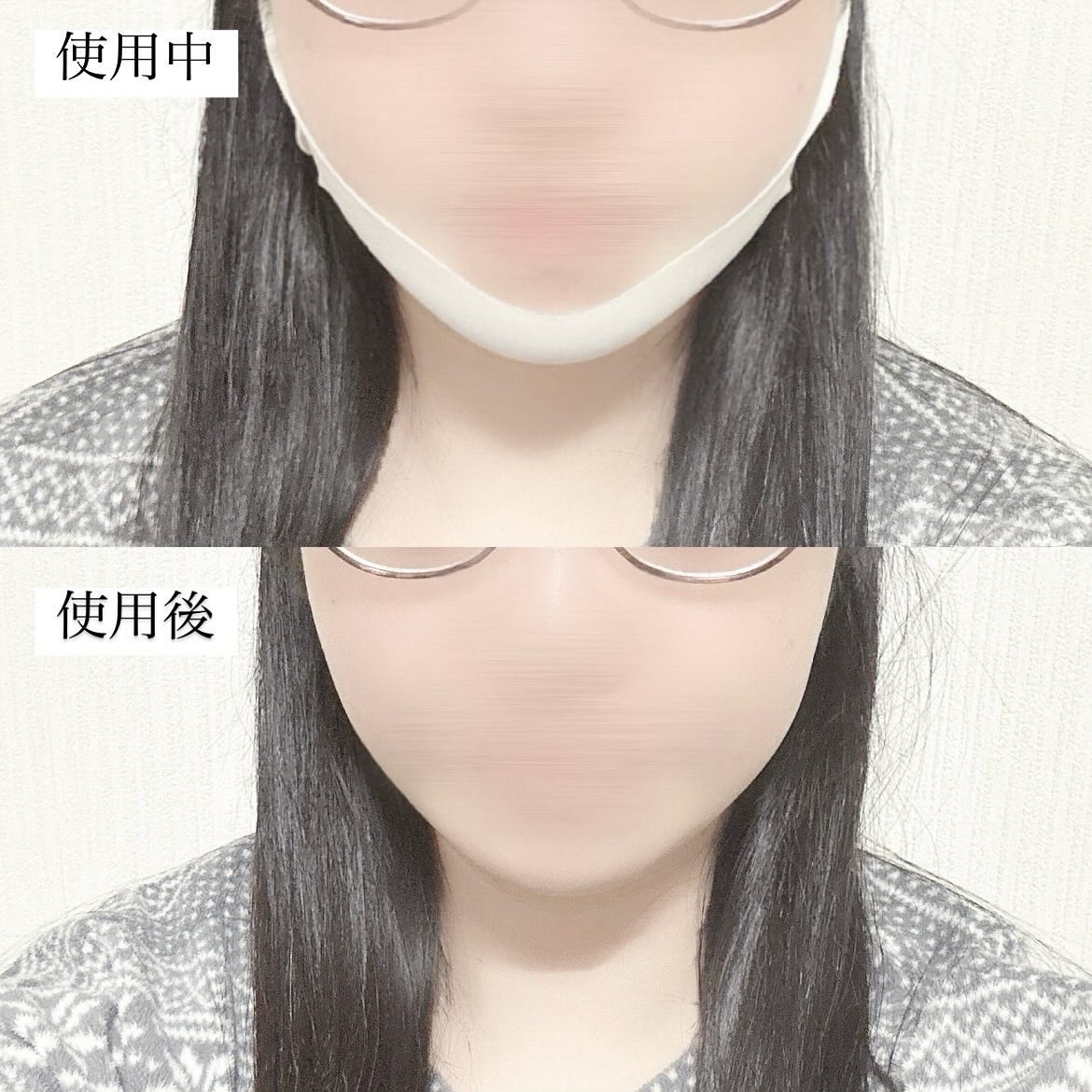 V-UP PATCH/WOOSHIN LABOTTACH/シートマスク・パックを使ったクチコミ（3枚目）