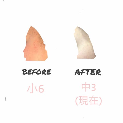 ハトムギ化粧水(ナチュリエ スキンコンディショナー R )/ナチュリエ/化粧水を使ったクチコミ(2枚目)