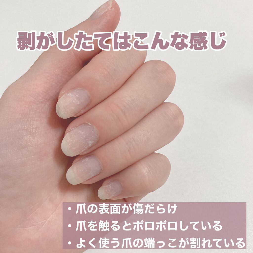 ネイルトリートメント N/ネイルネイル/ネイルオイル・トリートメントを使ったクチコミ（2枚目）