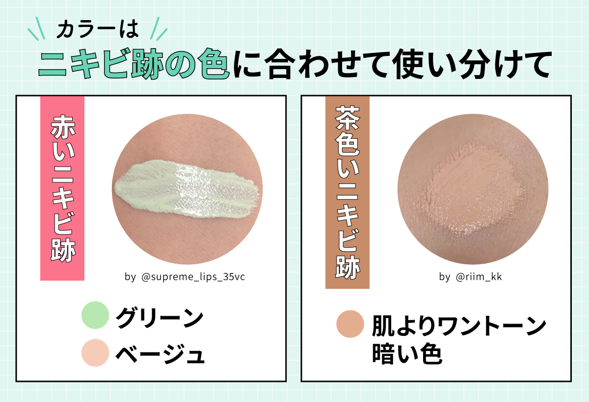 カラーはニキビ跡の色に合わせて使い分けて。赤いニキビ跡はグリーン・ベージュ、茶色いニキビ跡は肌よりワントーン暗い色。
