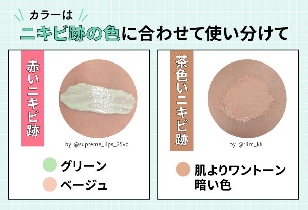 カラーはニキビ跡の色に合わせて使い分けて。赤いニキビ跡はグリーン・ベージュ、茶色いニキビ跡は肌よりワントーン暗い色。