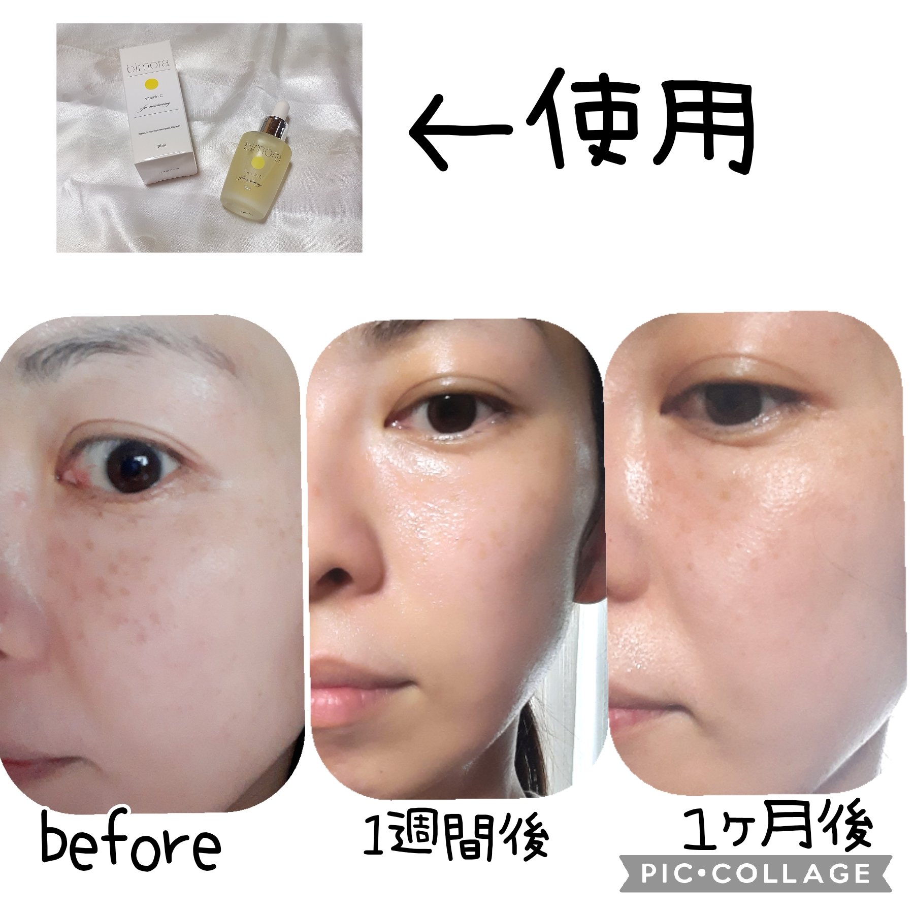 ビモラコスメ VC/BimoRa/美容液を使ったクチコミ（2枚目）