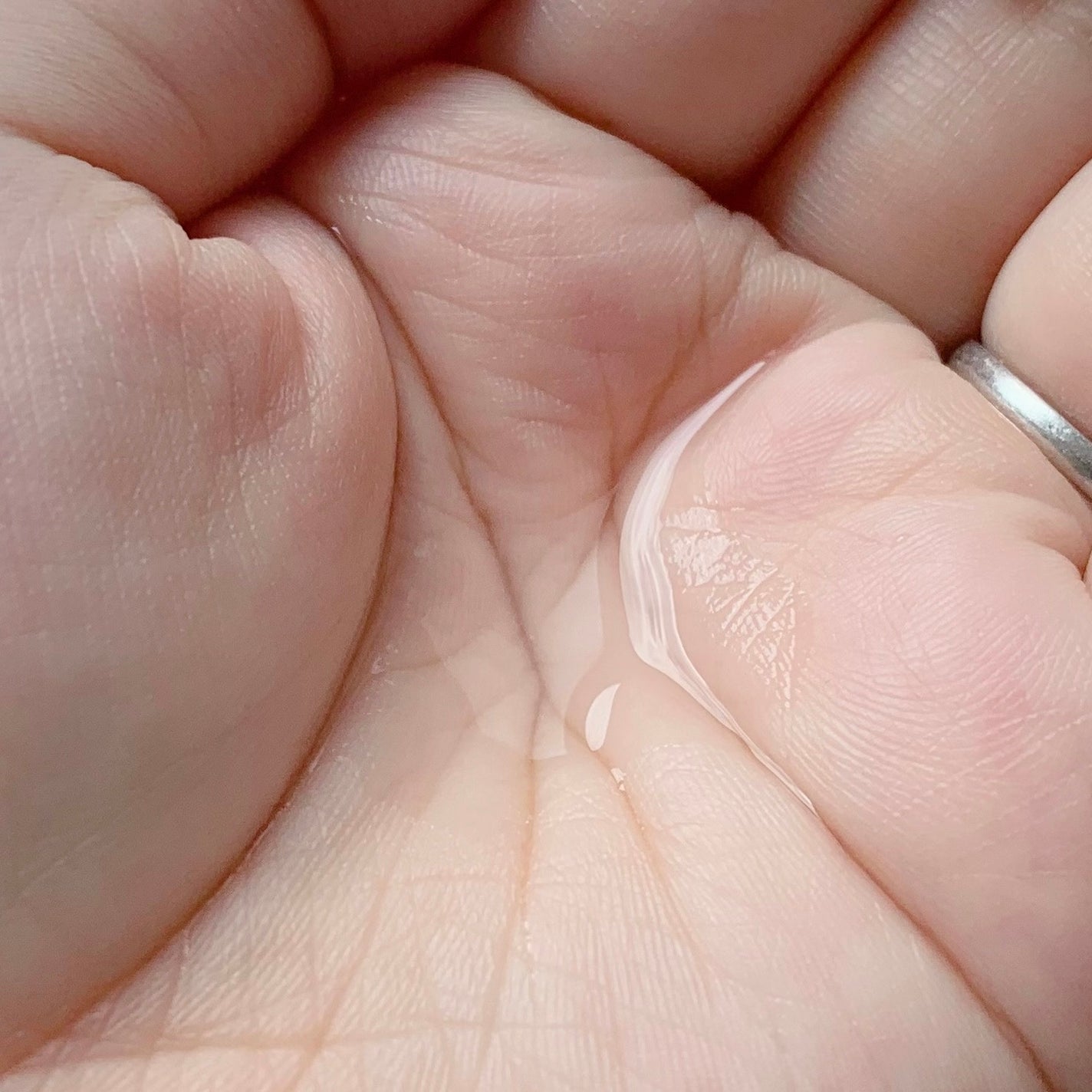 ピンクティーツリートナー/APLIN/化粧水を使ったクチコミ(5枚目)