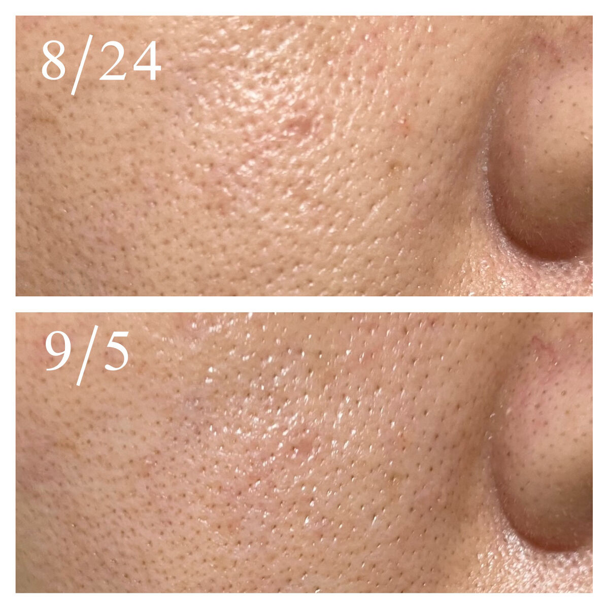 N10+Z1フェイスセラム /The Ordinary/美容液を使ったクチコミ（3枚目）