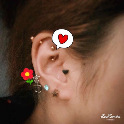 ヒビケア軟膏 (医薬品)/ムヒ/その他を使ったクチコミ(2枚目)