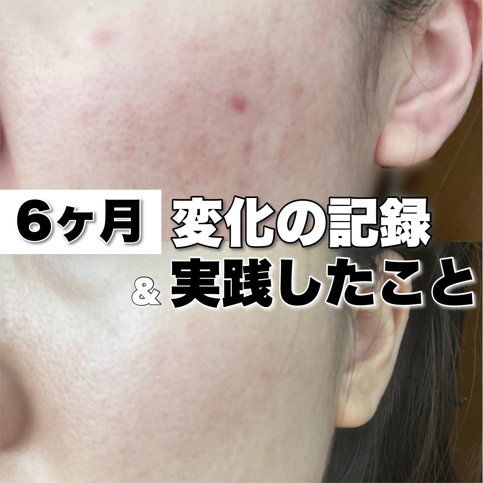 薬用ローション（とてもしっとり）/IHADA/化粧水を使ったクチコミ（1枚目）