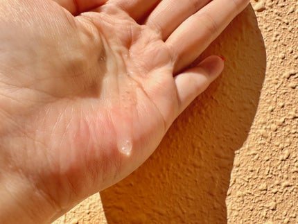 トーンブライトニング カプセルアンプル/SKIN1004/美容液を使ったクチコミ(4枚目)