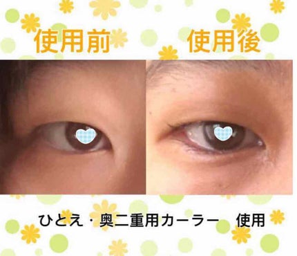 ひとえ・奥ぶたえ用カーラー/アイプチ®/ビューラーを使ったクチコミ(3枚目)