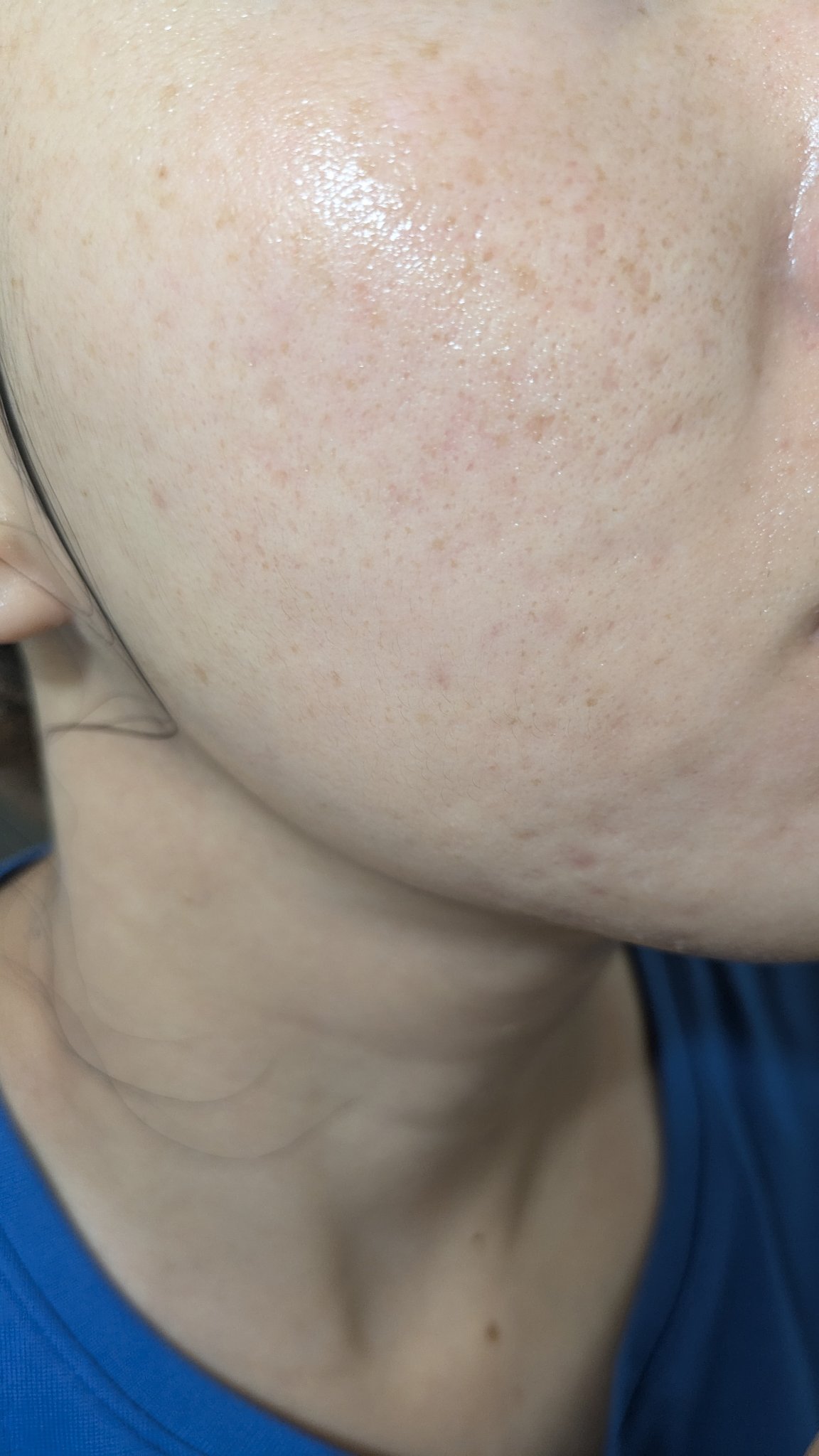 N10+Z1フェイスセラム /The Ordinary/美容液を使ったクチコミ（1枚目）