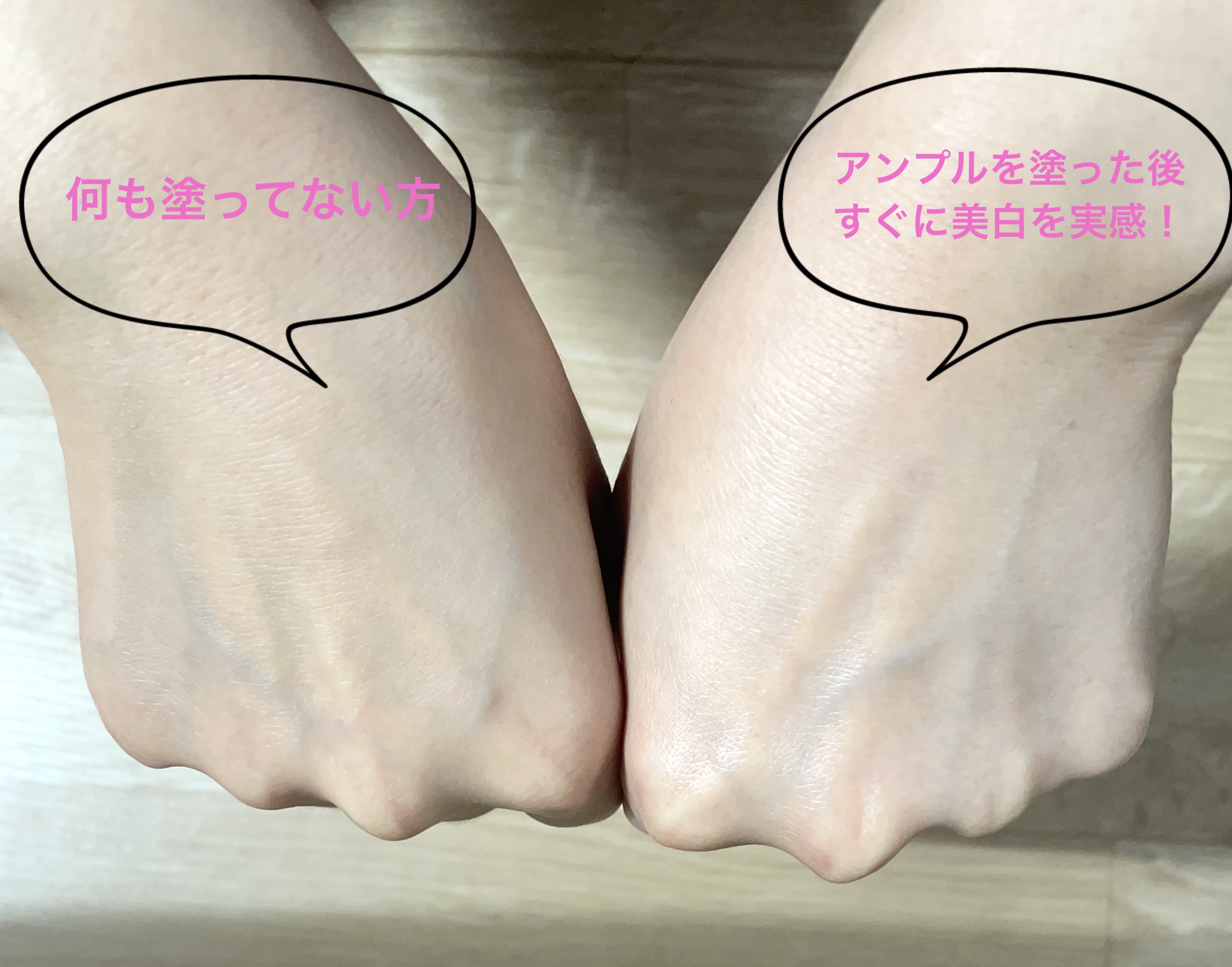 RXザ・ビタミンC23セラム/COSRX/美容液を使ったクチコミ（3枚目）