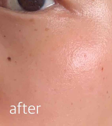 UVイデア XL プロテクショントーンアップ/ラ ロッシュ ポゼ/日焼け止めクリームを使ったクチコミ(3枚目)