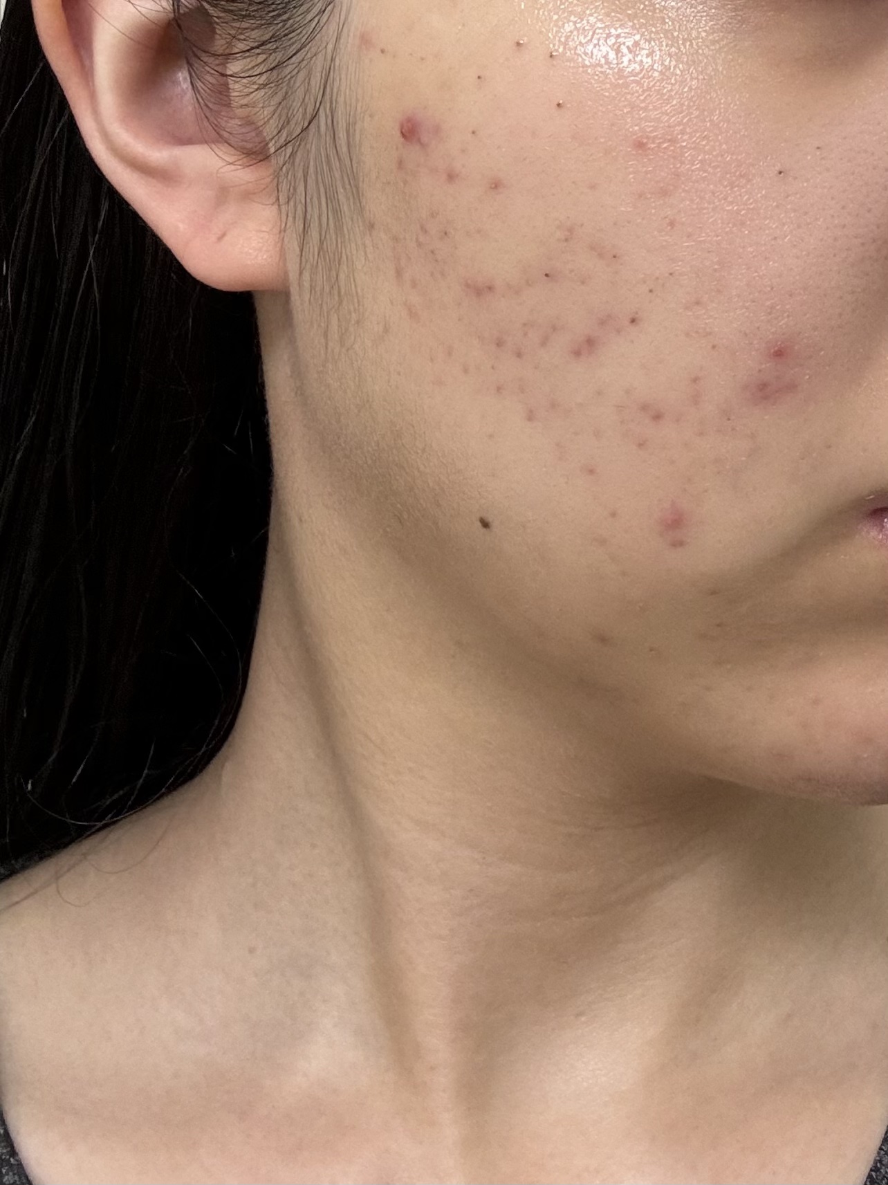 浸透湿潤セラミド１０％★ナノエマルジョン/TOUT VERT/乳液を使ったクチコミ（1枚目）