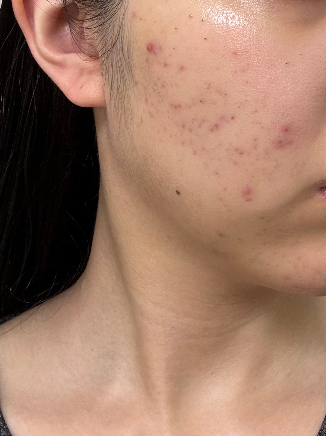 保湿浸透水バランシング/肌をうるおす保湿スキンケア/化粧水を使ったクチコミ(1枚目)